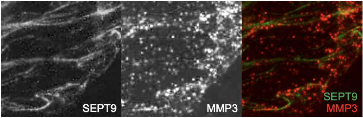 SEPT9 and MMP3 expression in mammary epithelial cells.